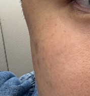 왼쪽 광대 원본