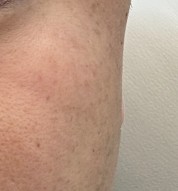 오른쪽 광대 원본