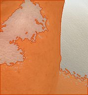 오른쪽 광대 색소 오버레이