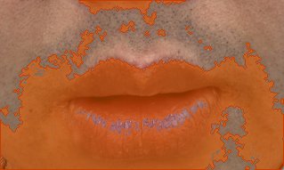 턱 색소 오버레이