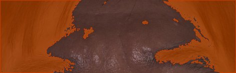 이마 색소 오버레이