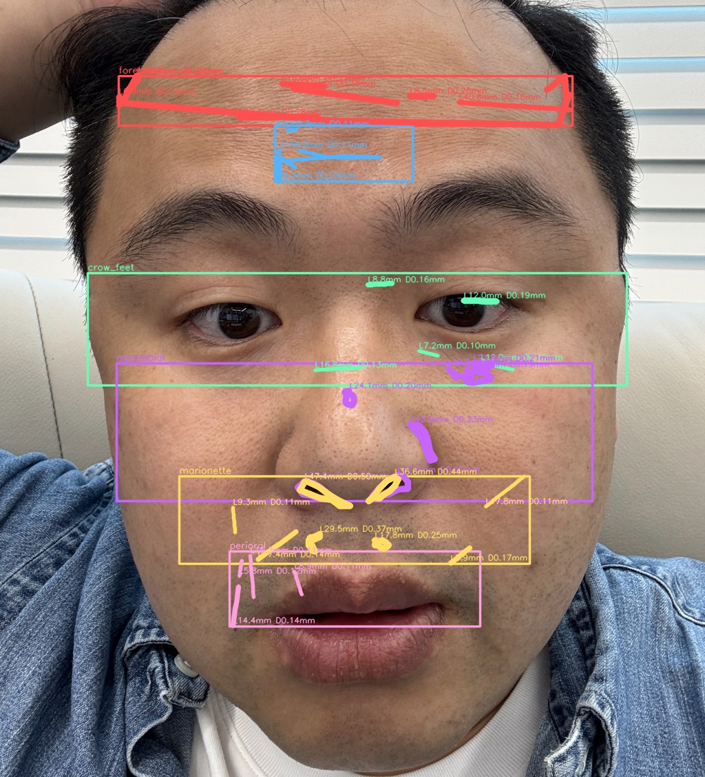 주름 전체 오버레이