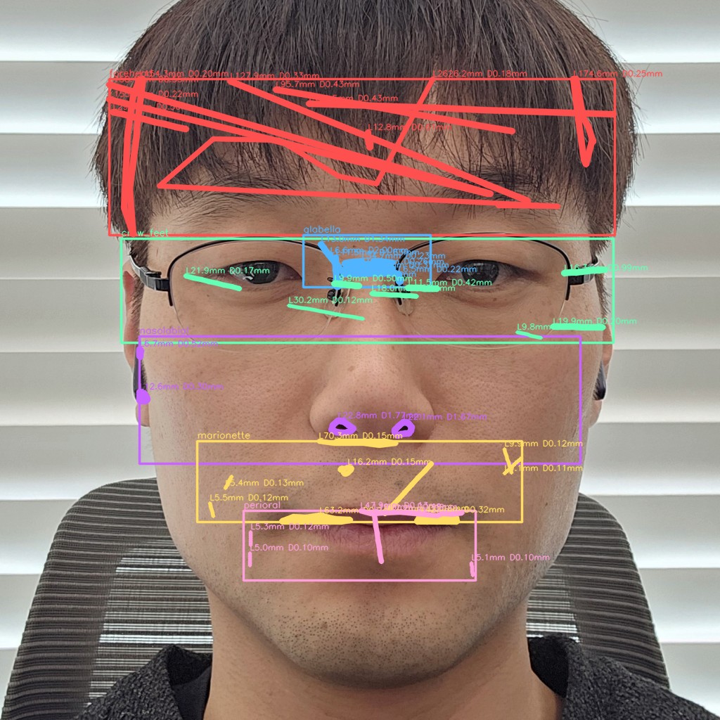 주름 전체 오버레이