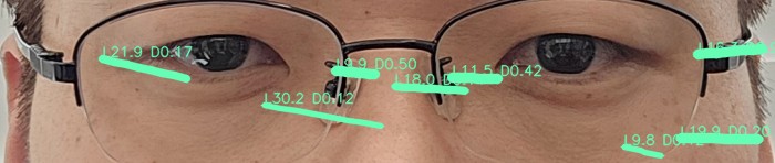 눈가 주름 오버레이