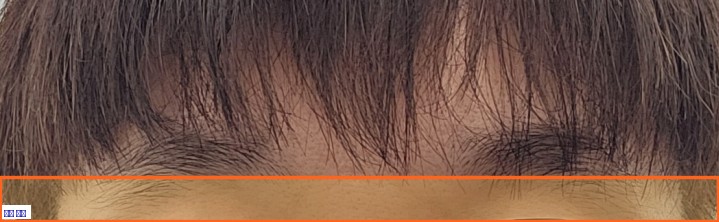 이마 원본 크롭