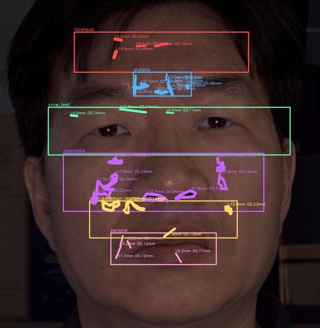 주름 전체 오버레이