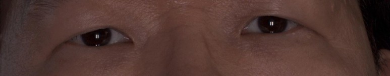 눈가 원본 크롭