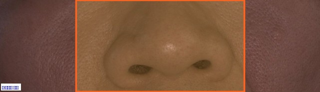 팔자주름 원본 크롭