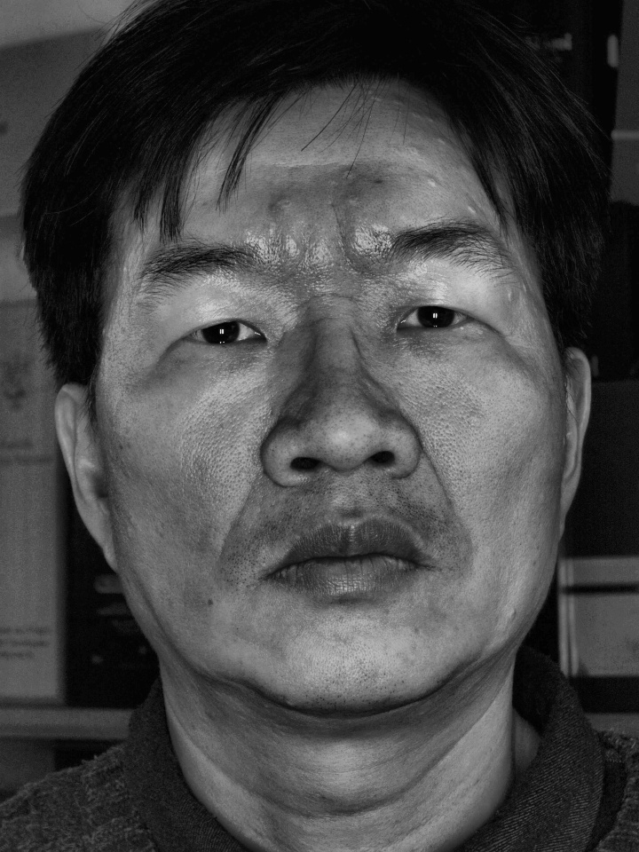 ② 전처리 — CLAHE 대비 강화