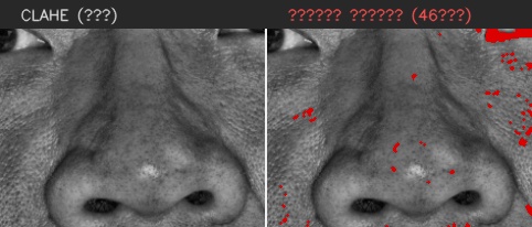⑤ 코 — 모공 검출
