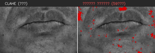 ⑧ 턱 — 모공 검출