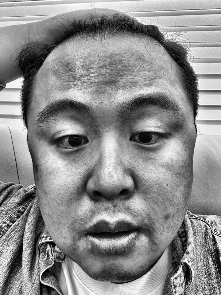 ② 전처리 — CLAHE 대비 강화