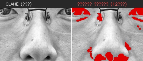 ⑤ 코 — 모공 검출