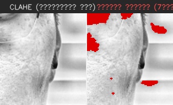 ⑦ 오른쪽 볼 — 모공 검출