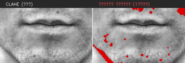 ⑧ 턱 — 모공 검출